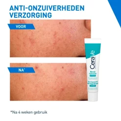 Geconcentreerde Anti-Onzuiverheden Verzorging|CeraVe Clearance