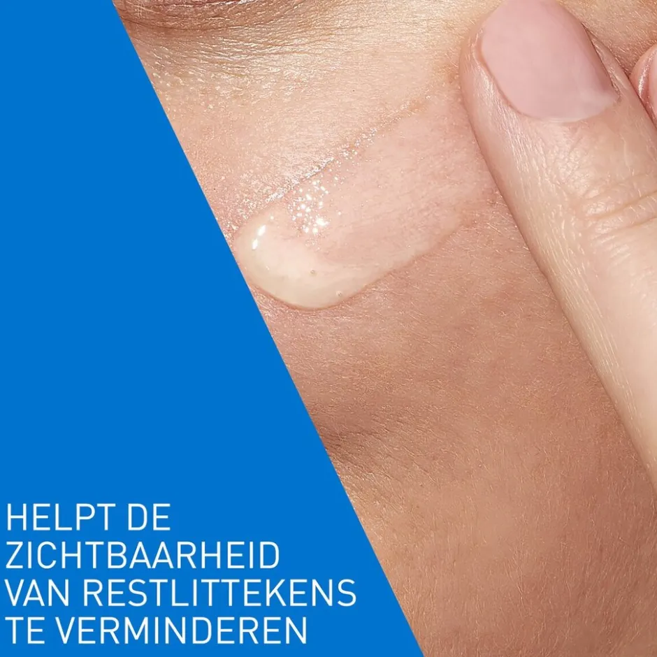 CeraVe Retinol Serum Tegen Post-Acne Vlekjes< Dermacare|Serum