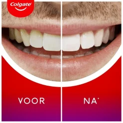 Max White Overnight Whitening Serum|Colgate Clearance