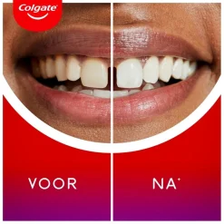 Colgate Max White Ultimate Radiance Tandpasta< Tandpasta