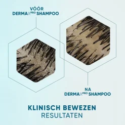 Head & Shoulders DermaXPro by Hydrateert Antiroosshampoo< Shampoo