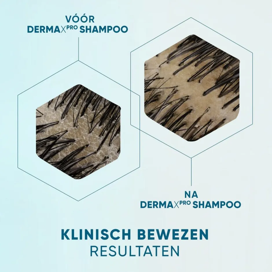 Head & Shoulders DermaXPro by Hydrateert Antiroosshampoo< Shampoo