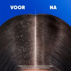 Classic 2-in-1 Antiroosshampoo|Head & Shoulders Online