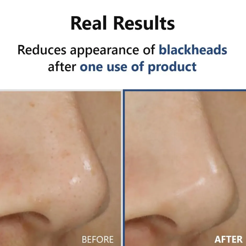 ISNTREE Hyper Acid4 AHA BHA PHA LHA 30 Serum< Korean Skincare|Serum