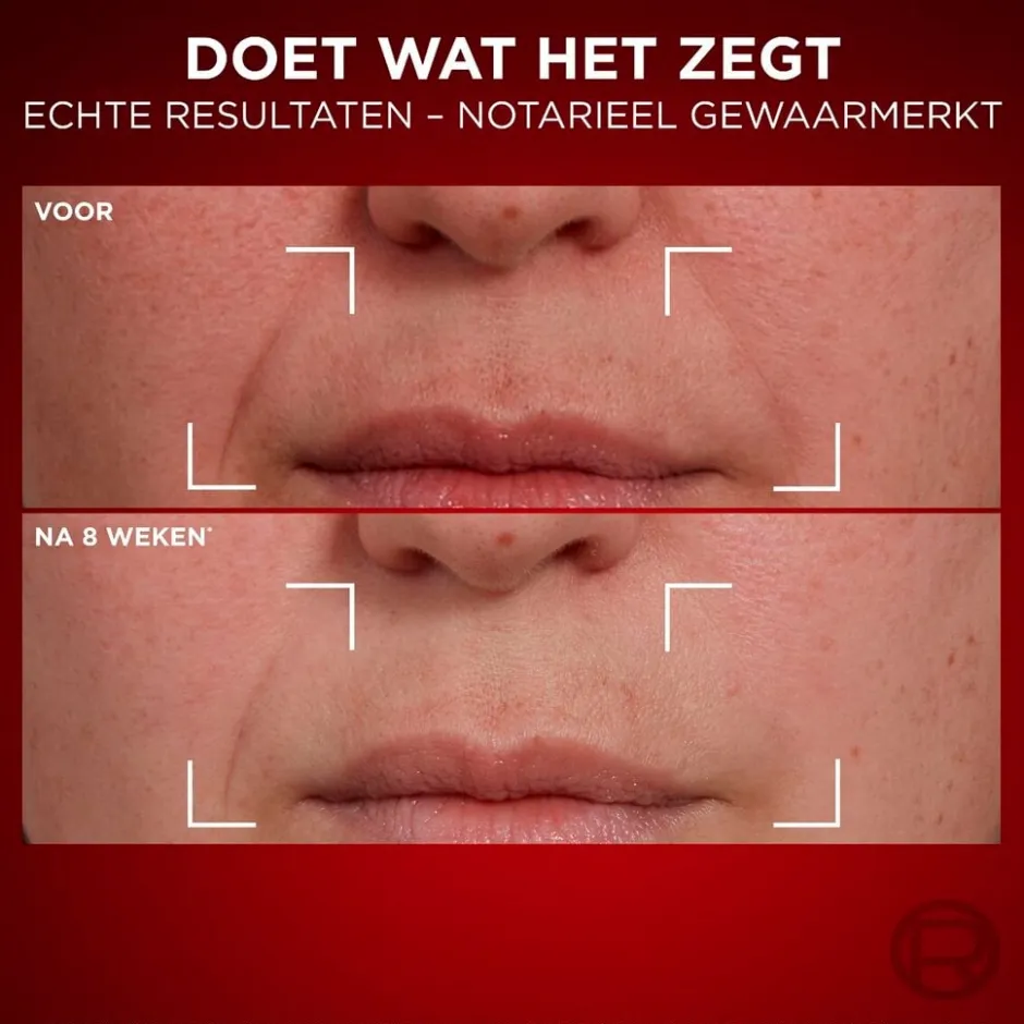 L'Oréal Paris Revitalift Laser Anti-Rimpel Dagcrème|L'Oreal Paris Online