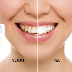 Luxury White Ultimate Whitening+< Whitening Producten