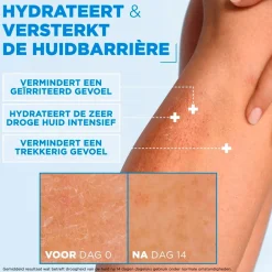 Ceramide Protect Hydraterende Crème|Mixa