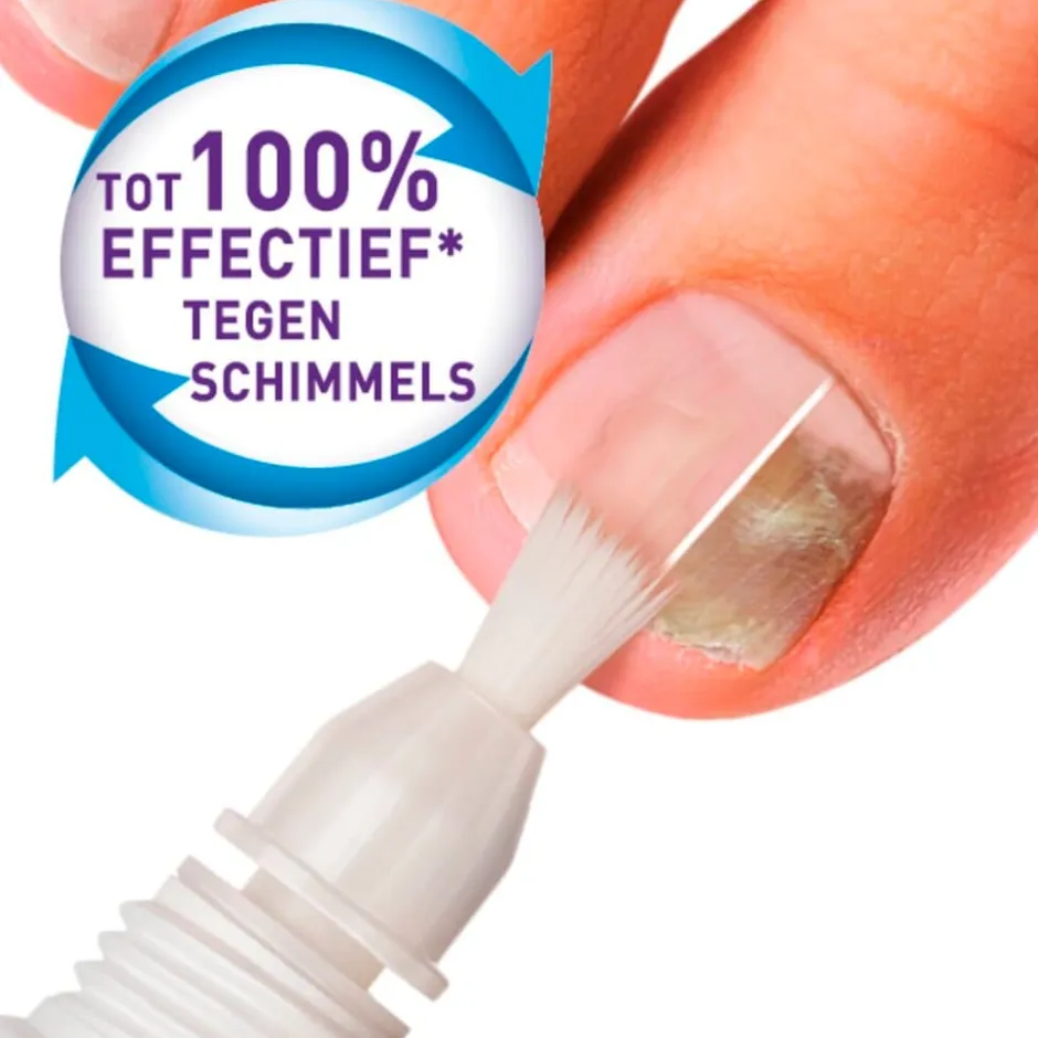 Kalknagel Behandelset|Mycosan Clearance