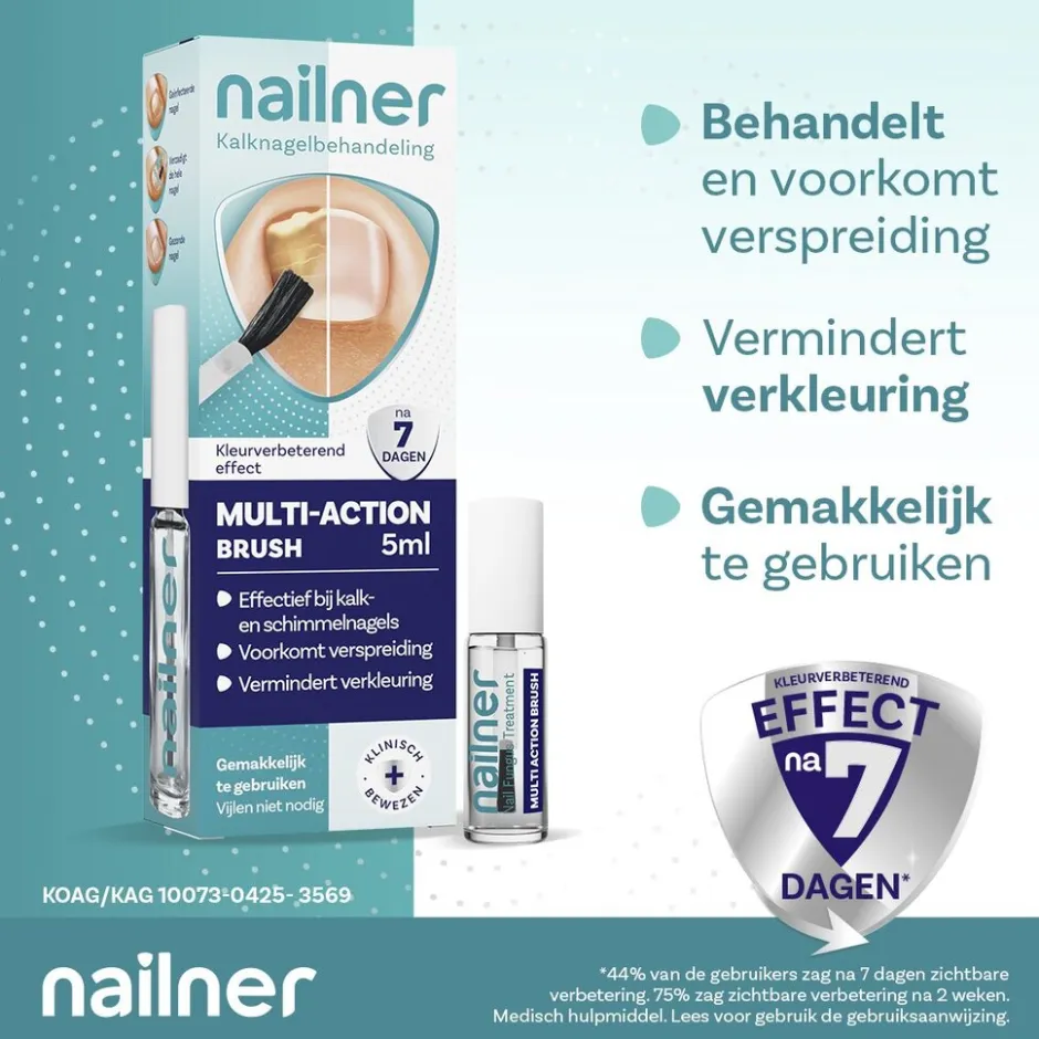 Nailner Multi-Action 2-in-1 Kalknagelkwastje< Kalknagels