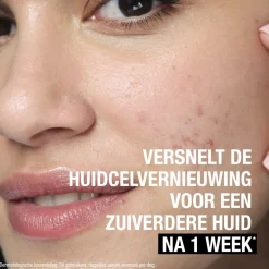 Neutrogena Anti-Puistjes+ 7% AHA + Panthenol Vloeibare Exfoliant< Dermacare|Exfoliant