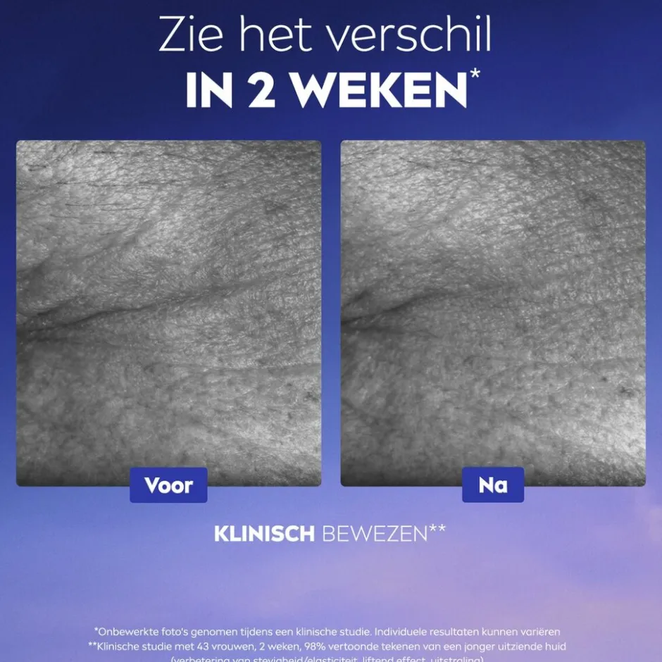 NIVEA Cellular Epigenetics Ultiem Huidverjongend Serum|Nivea Skincare