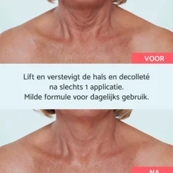 Hals & Décolleté Crème|Remescar Best
