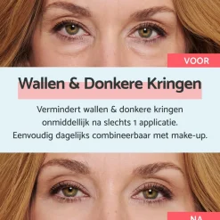 Wallen & Donkere Kringen Crème|Remescar Best