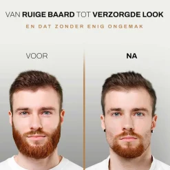Sansbeauté 6-in-1 Baardtrimmer Met Opbergstandaard - Bodygroomer - Haartrimmer<Heren Baardtrimmers
