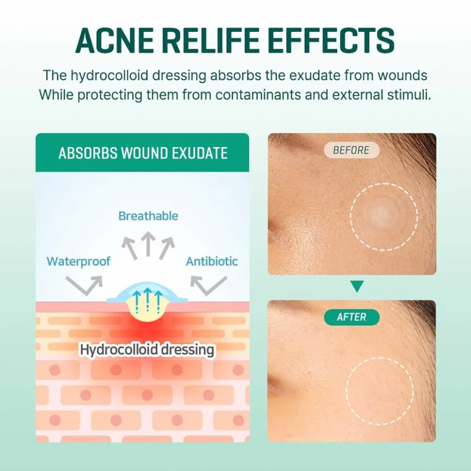 SOMEBYMI SOME BY MI Clear Spot Patch*2ea< Pimple Patches