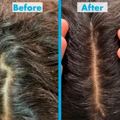 Umberto Giannini Scalp Scrub< Haartreatment