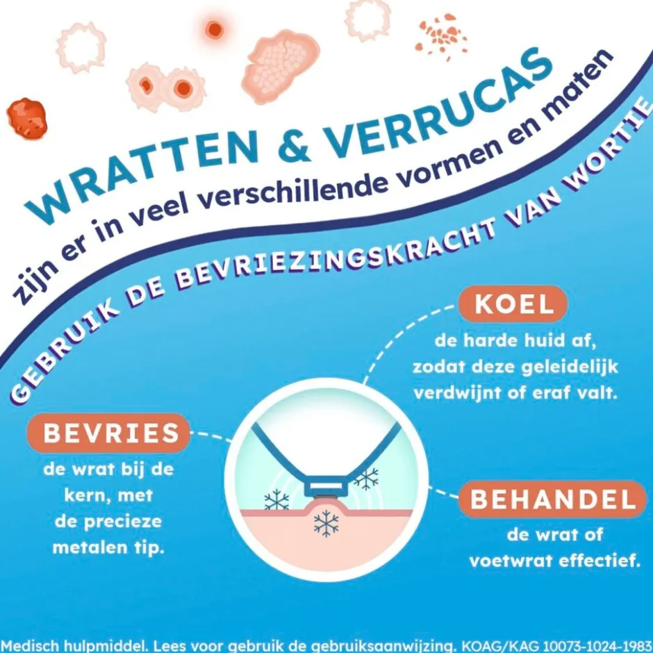 Freeze Wrattenverwijderaar|Wortie Outlet
